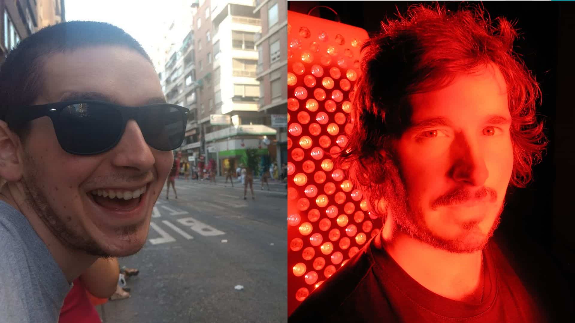 Side by side comparison of short buzz cut before red light vs thicker longer hair after red light